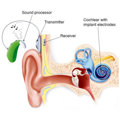 Best Speech and Hearing Centre in Faridabad